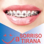 Sorriso a tirana